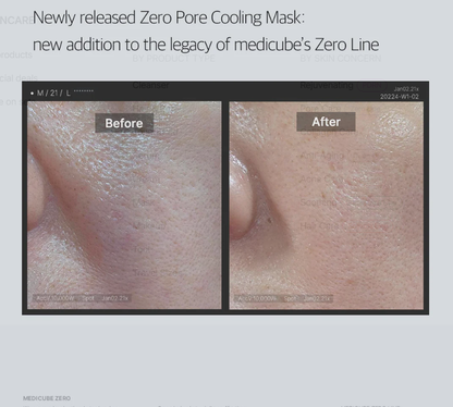Medicube Zero Pore Cooling Facial Mask