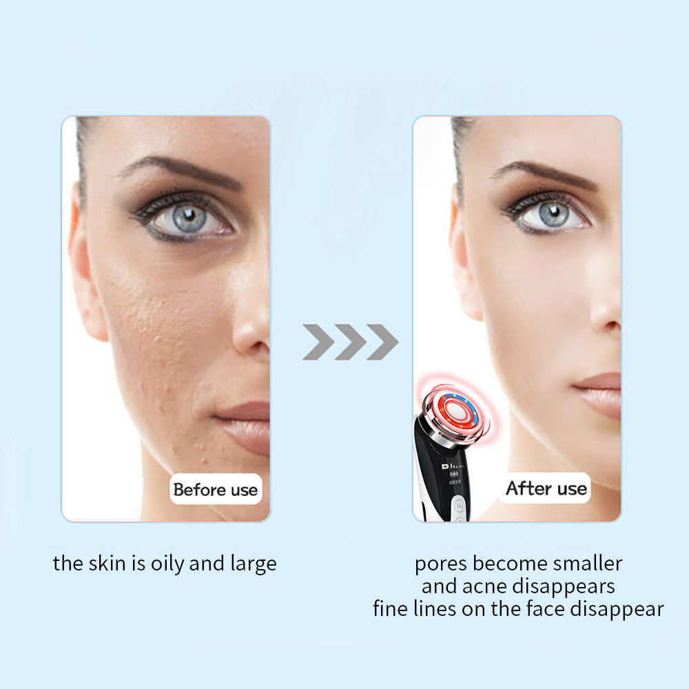 Anti-Aging Electric Facial Skin Massager